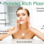 prp behandelingen