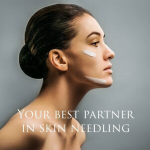 Microneedling gelaatsverzorging